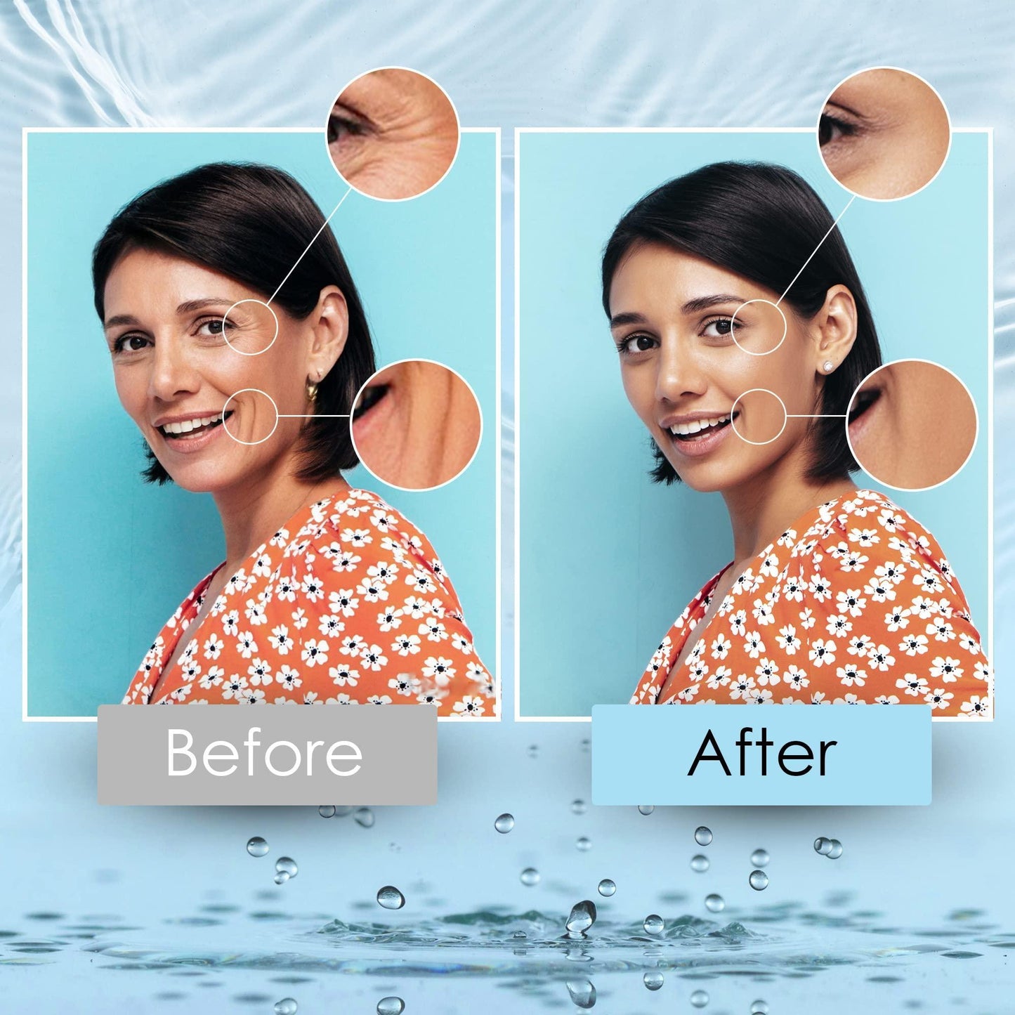 Hyaluronic Acid Serums