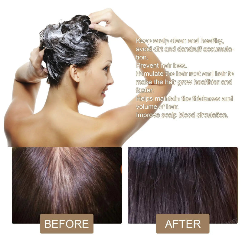 EELHOE Rice Soap for Hair Growth – Nourishing Rice Soap 100g