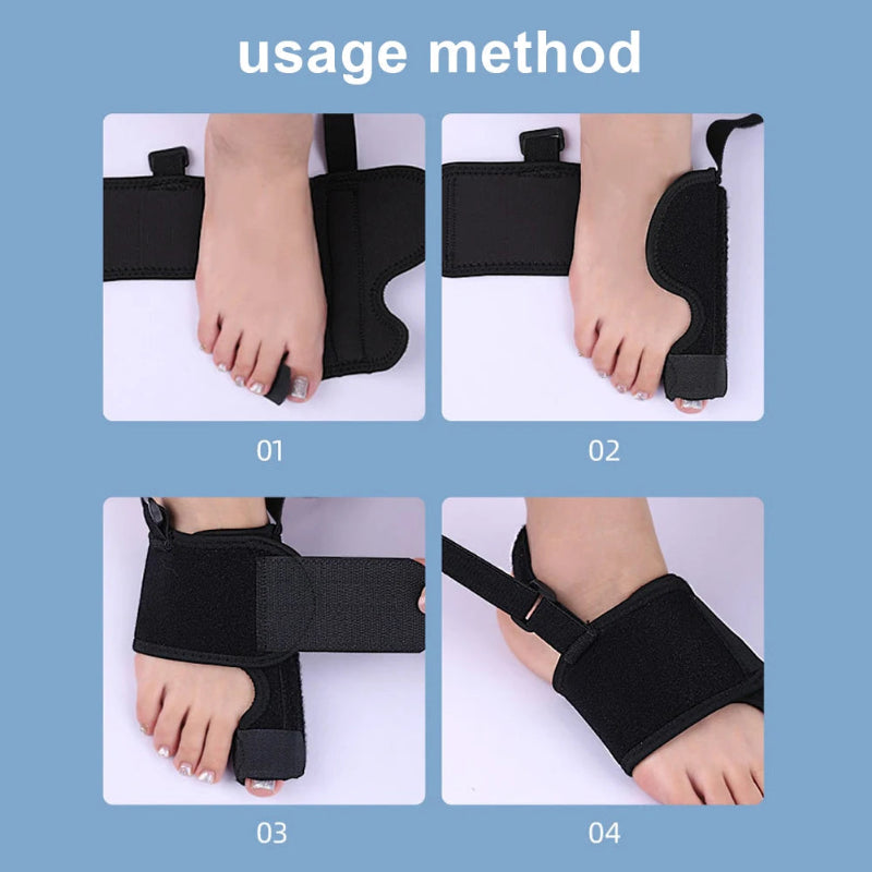Adjustable Bunion Corrector Toe Splint