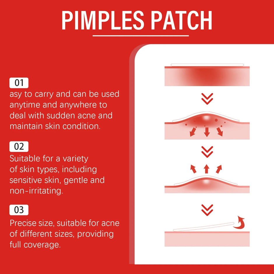 240-Piece Heart & Star Pimple Patches – Acne Dots for Blemish Coverage