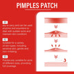 240-Piece Heart & Star Pimple Patches – Acne Dots for Blemish Coverage