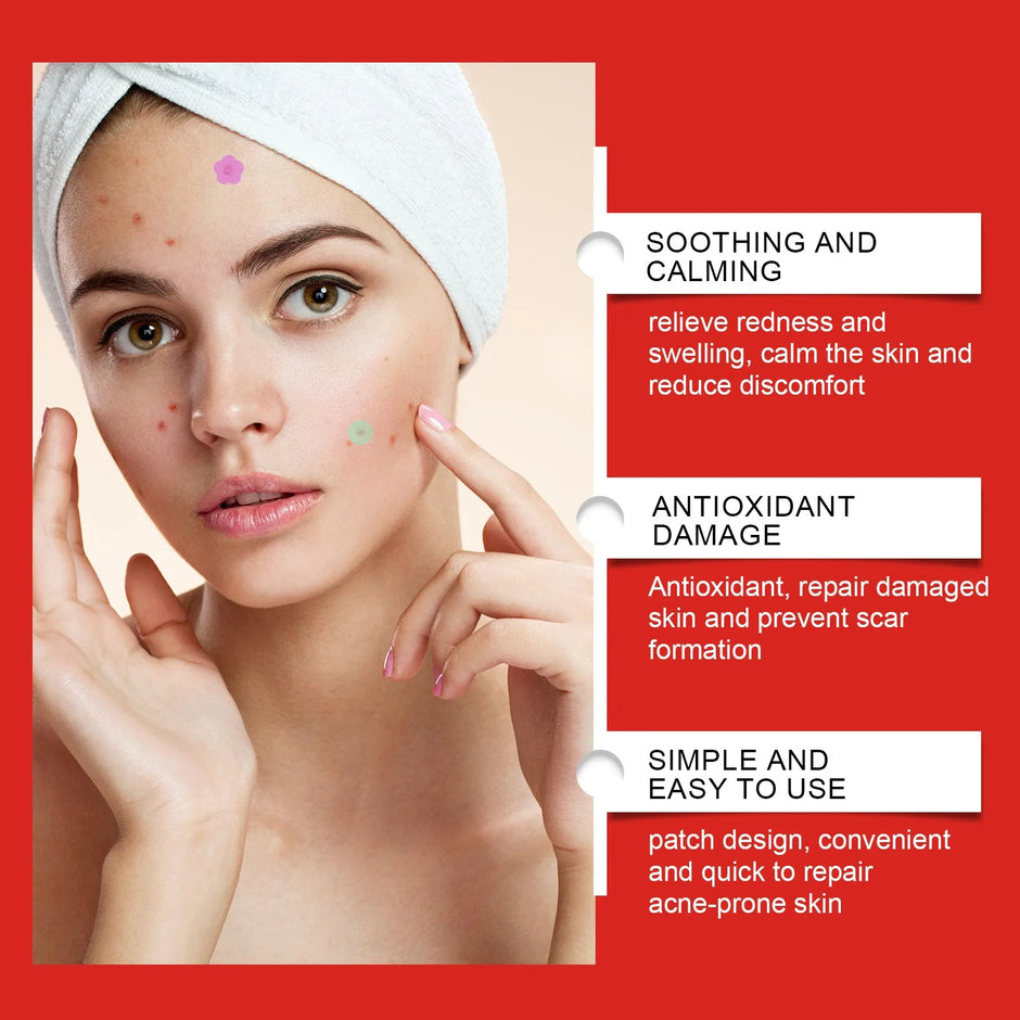240-Piece Heart & Star Pimple Patches – Acne Dots for Blemish Coverage