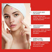 240-Piece Heart & Star Pimple Patches – Acne Dots for Blemish Coverage