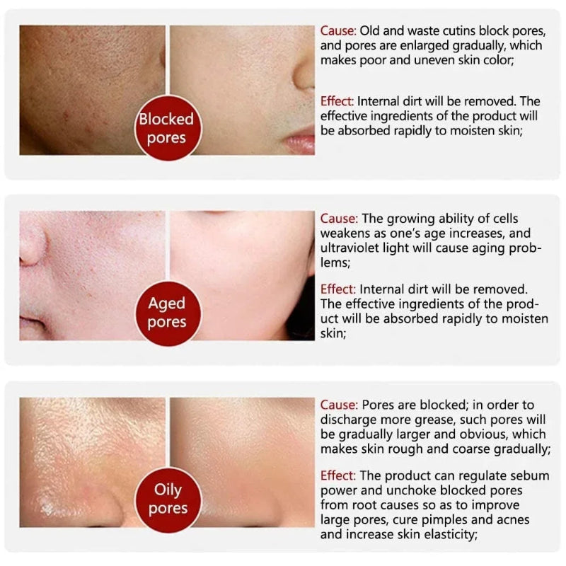 Skin Texture Pore Refining Facial Serum with Retinol & Niacinamide Brightening Skincare Treatment
