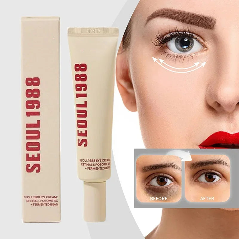 Seoul 1988 Retinol Eye Cream 4% Anti Aging Eye Treatment for Dark Circles Wrinkles Puffiness