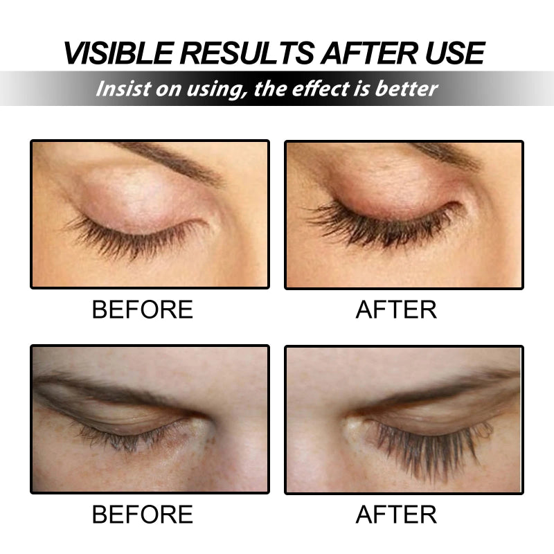EELHOE Eyelash Boost Serum