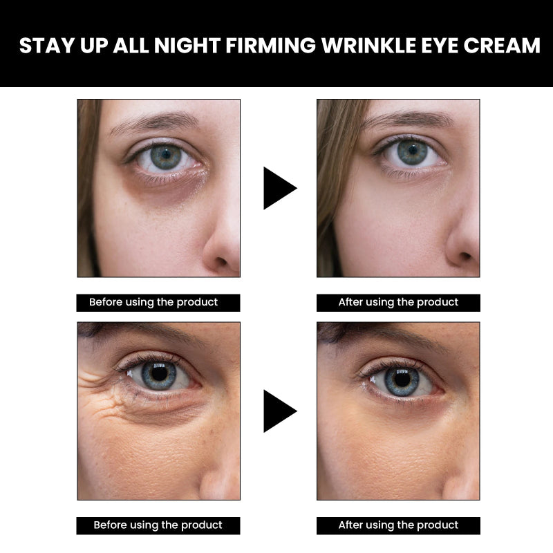EELHOE Eye Cream - Conopeptide Stay Up All Night Firming Wrinkle Eye Cream 20g for Revitalized Eyes
