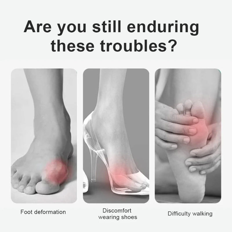 Adjustable Bunion Corrector Toe Splint