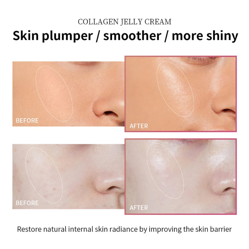 lakerain Collagen Jelly Cream 100ml – Hydrolyzed Collagen & Niacinamide Moisturizer for Face, Neck & Hands