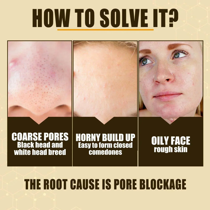 Pore Shrink Face Serum Oil Control Moisturizing Facial Essence for Skin Care