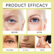OUHOE Retinal Cream Anti-Aging Face Moisturizer for Women Firming Brightening Deep Hydration Night Cream