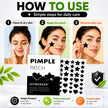 360PCS Heart & Star Acne Pimple Patches – Hydrocolloid Blemish Spot Stickers