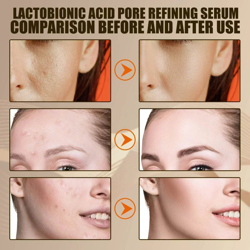 Pore Shrink Face Serum Oil Control Moisturizing Facial Essence for Skin Care