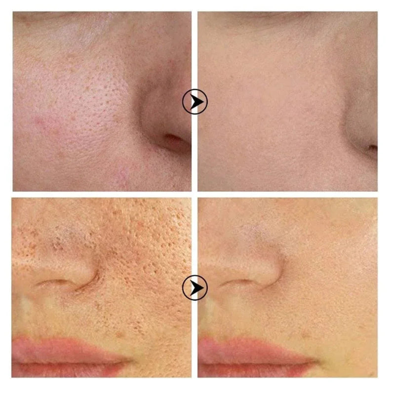 Skin Texture Pore Refining Facial Serum with Retinol & Niacinamide Brightening Skincare Treatment