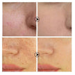 Skin Texture Pore Refining Facial Serum with Retinol & Niacinamide Brightening Skincare Treatment