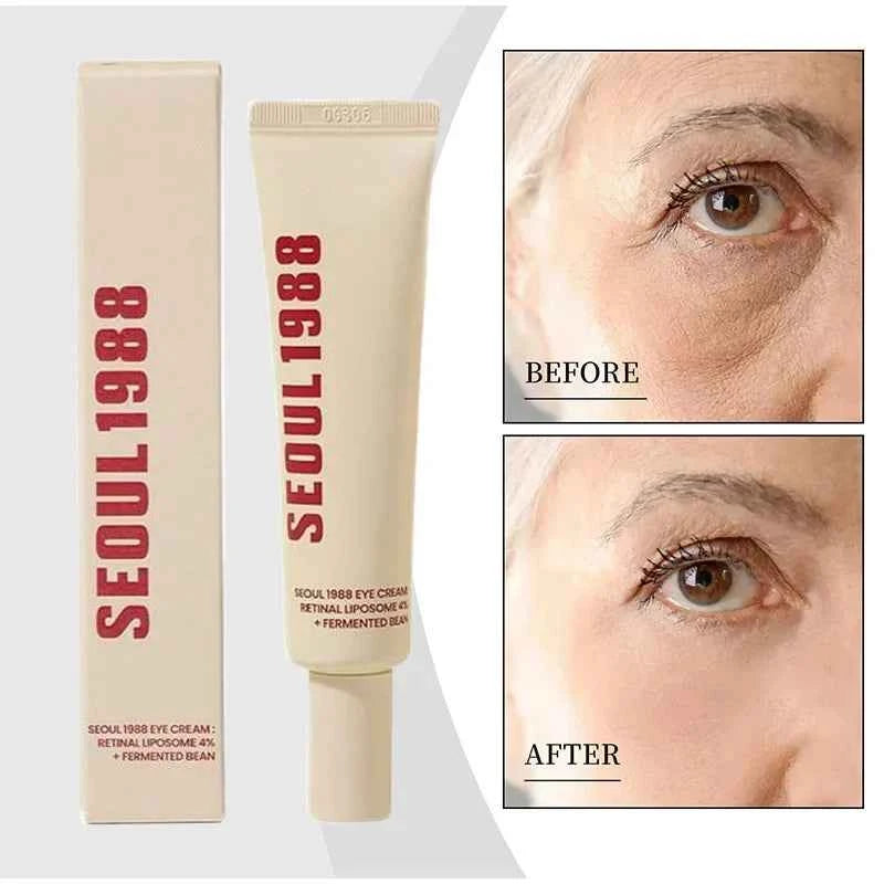 Seoul 1988 Retinol Eye Cream 4% Anti Aging Eye Treatment for Dark Circles Wrinkles Puffiness