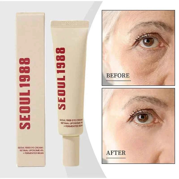 Seoul 1988 Retinol Eye Cream 4% Anti Aging Eye Treatment for Dark Circles Wrinkles Puffiness