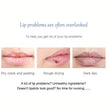 Lip Balm Exfoliating Scrub – Moisturizing Lip Care Mask for Smooth, Hydrated & Soft Lips