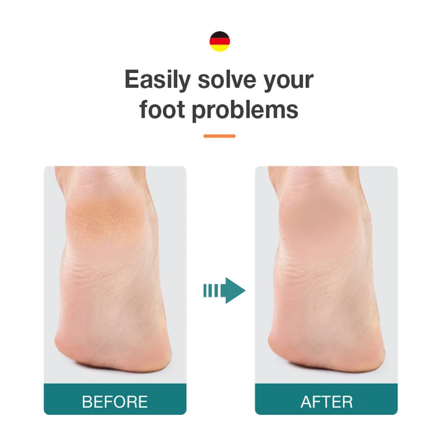 KINGREEN Foot File - Dual-Sided for Smooth, Soft Feet - 210mm Size