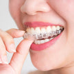 Clear Dental Mouth Guard Transparent Teeth Tray