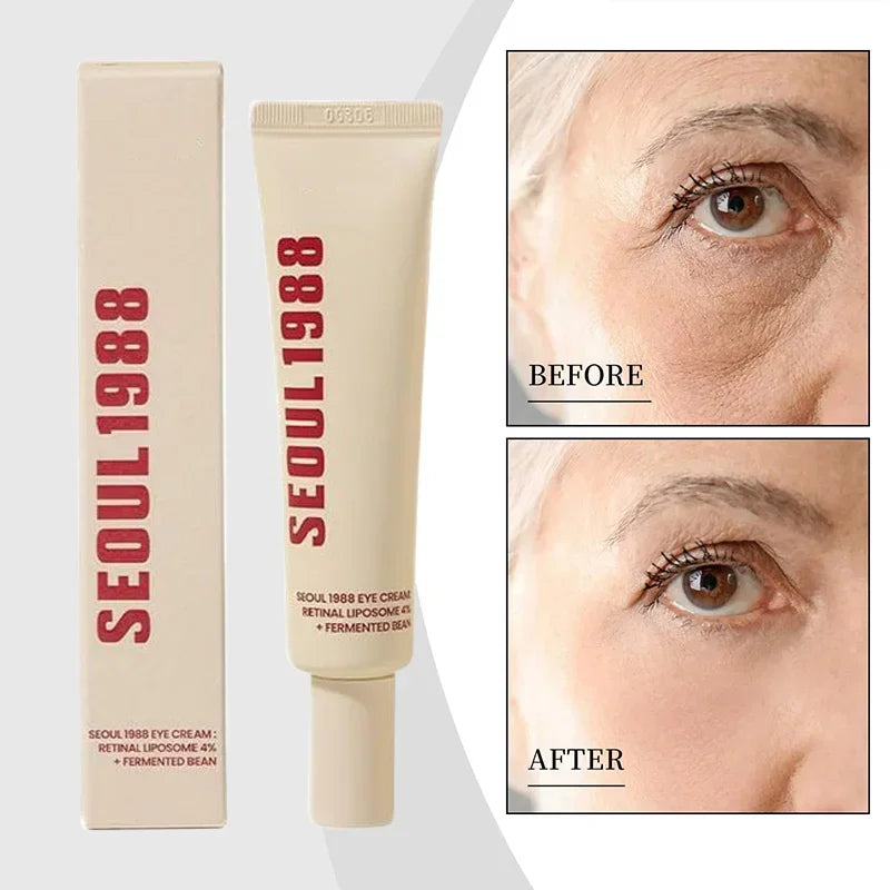 Seoul 1988 Retinol Eye Cream 4% Anti Aging Eye Treatment for Dark Circles Wrinkles Puffiness