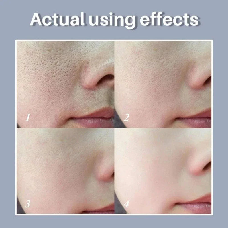 Skin Texture Pore Refining Facial Serum with Retinol & Niacinamide Brightening Skincare Treatment